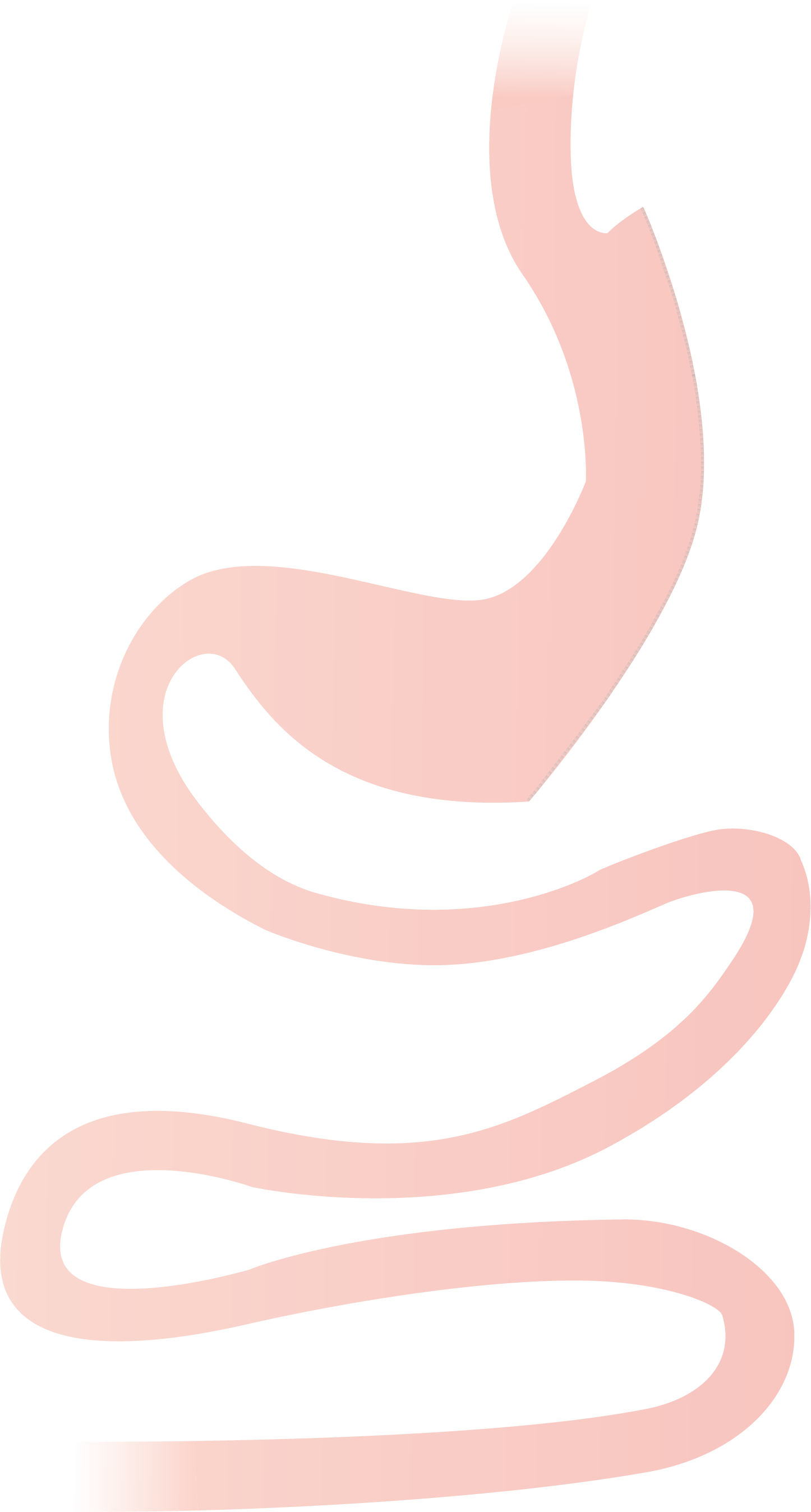 Sleeve gastrectomie schema